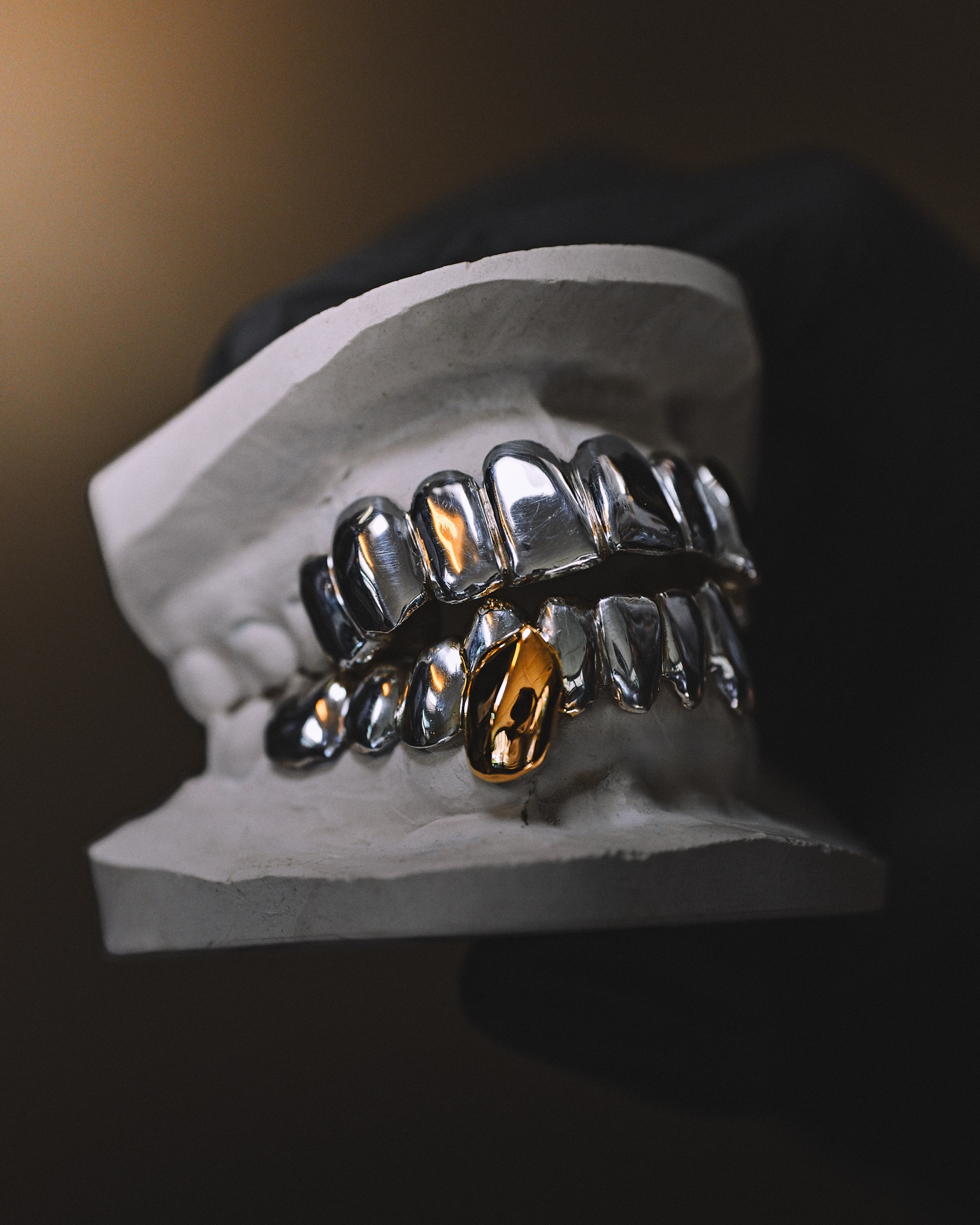 Détail or 18 carats sur un grillz pleine bouche